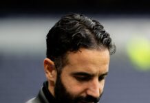 Manchester United har et stort dilemma